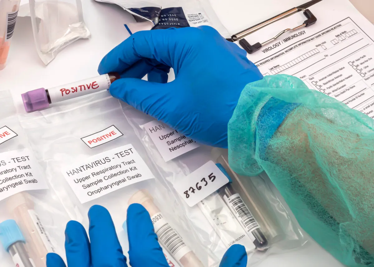 Venezuela confirma tres fallecimientos por hantavirus e investiga la muerte de dos sanitarios