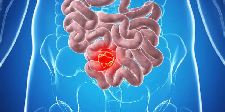 Este aminoácido puede ayudar al cuerpo a combatir tumores e infecciones viraleswebp