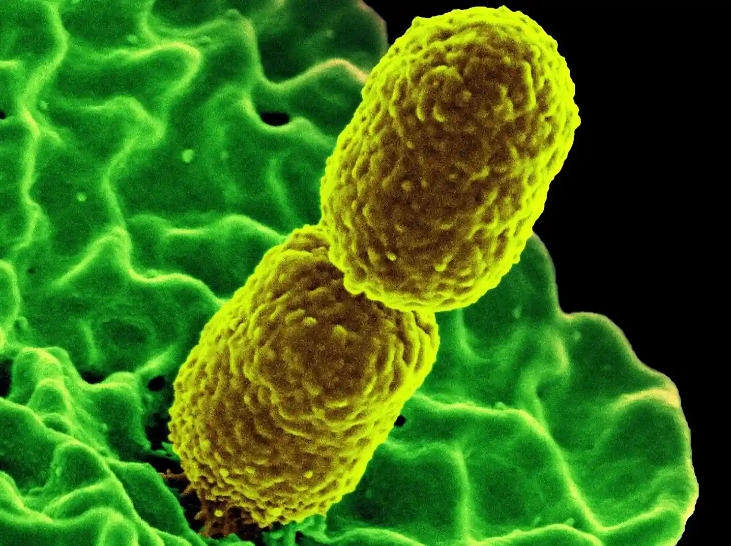 Superbacteria confirmada en 23 estados